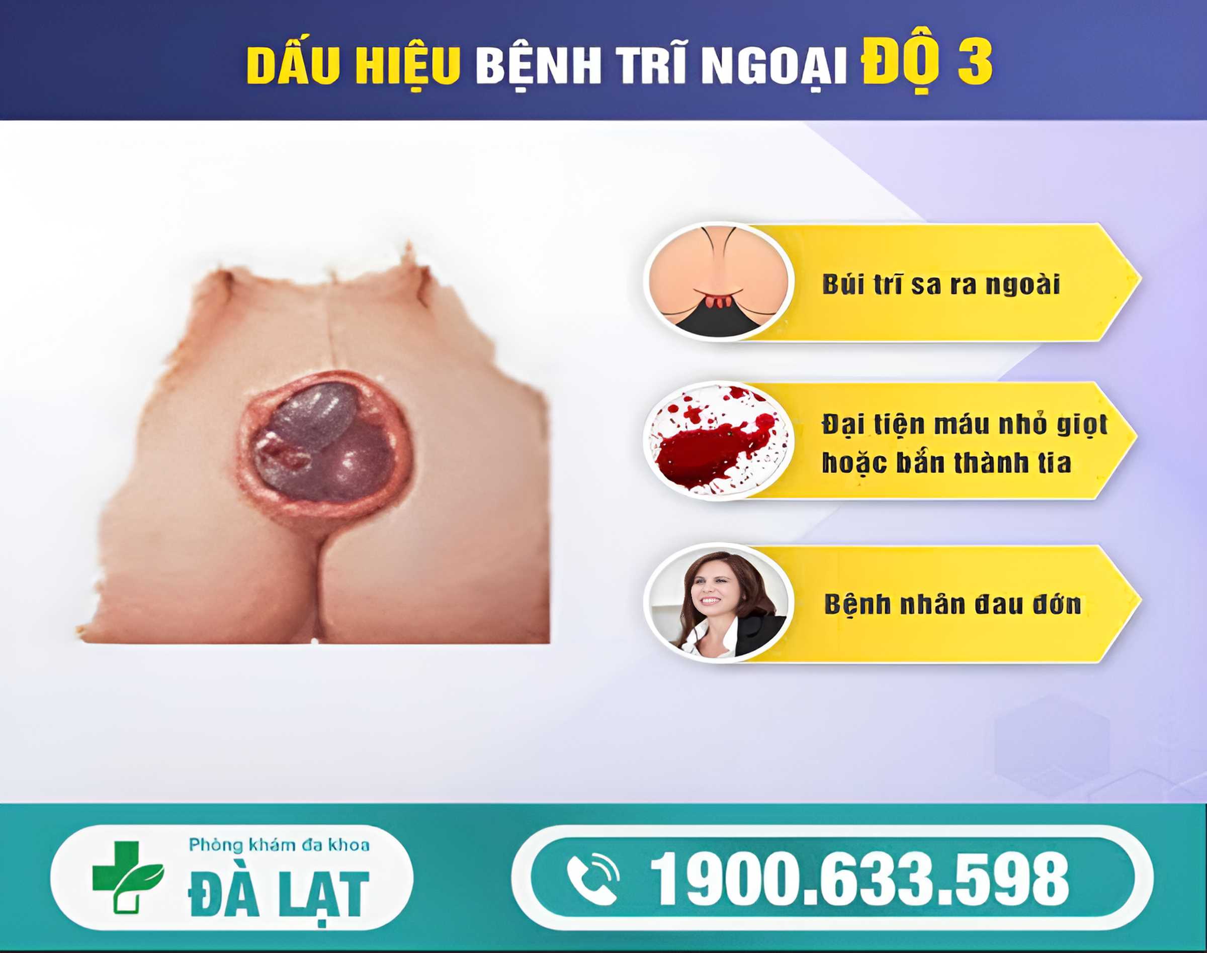 Hình ảnh minh họa